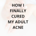 How i cured my adult acne